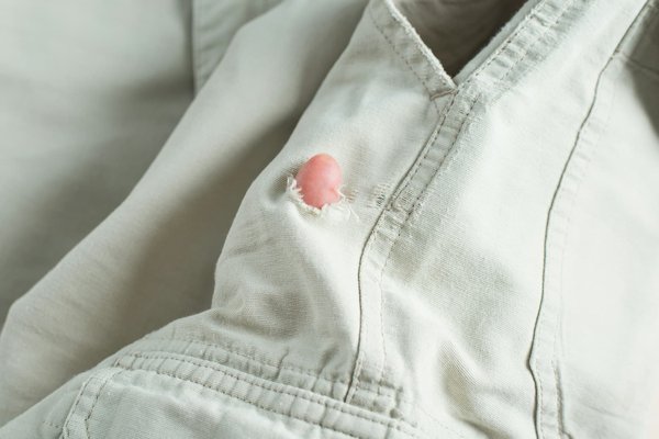 Traitement mite vêtement : le guide pour réussir